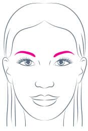 Brow Lift