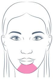 Chin Enhancement