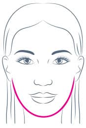 Jawline Correction