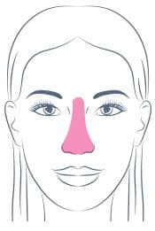 Non-Surgical Nose Shaping