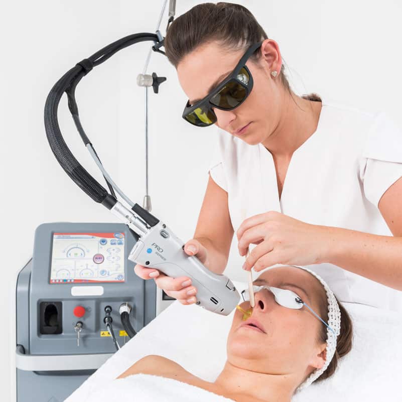 Laser Hair Removal