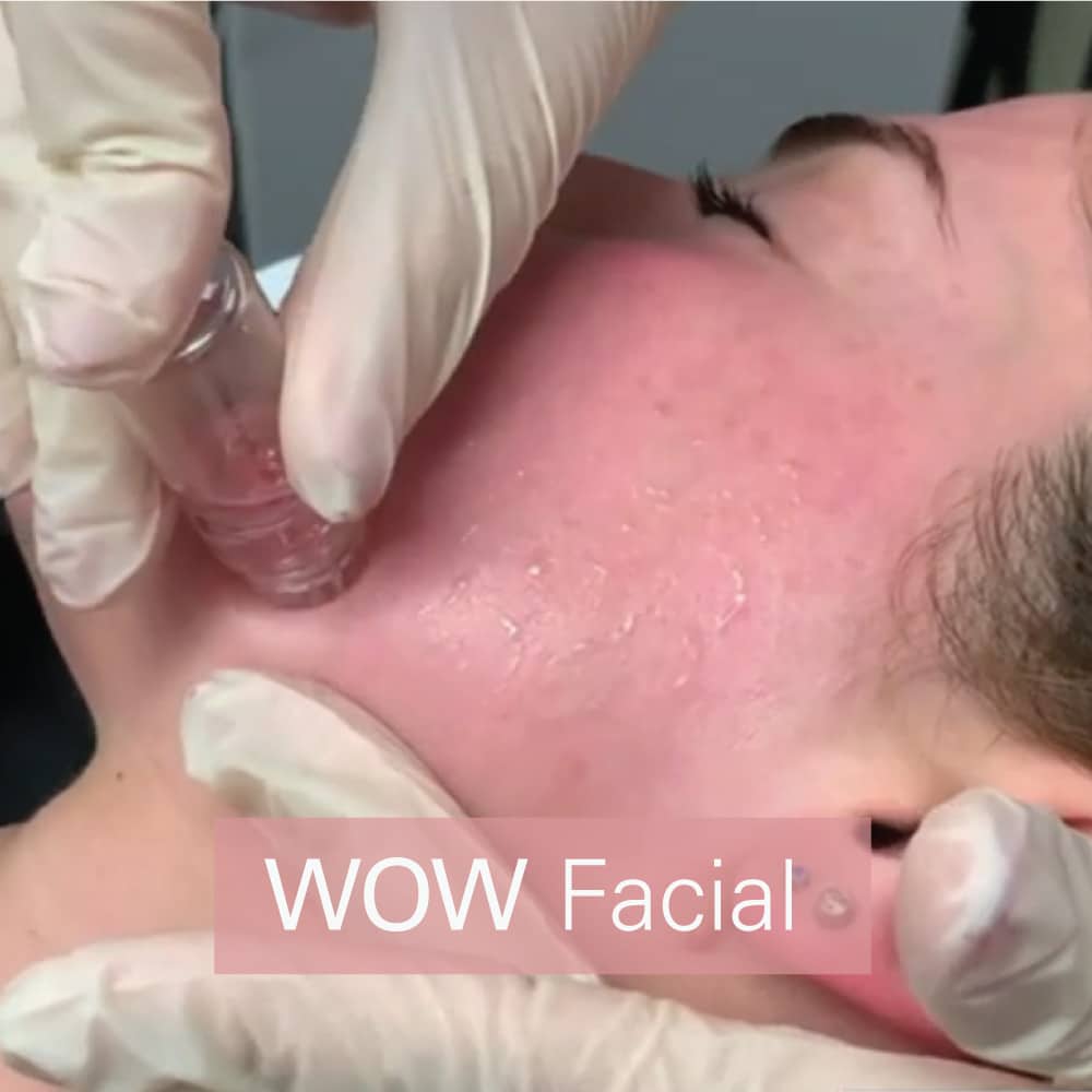 Wow facial