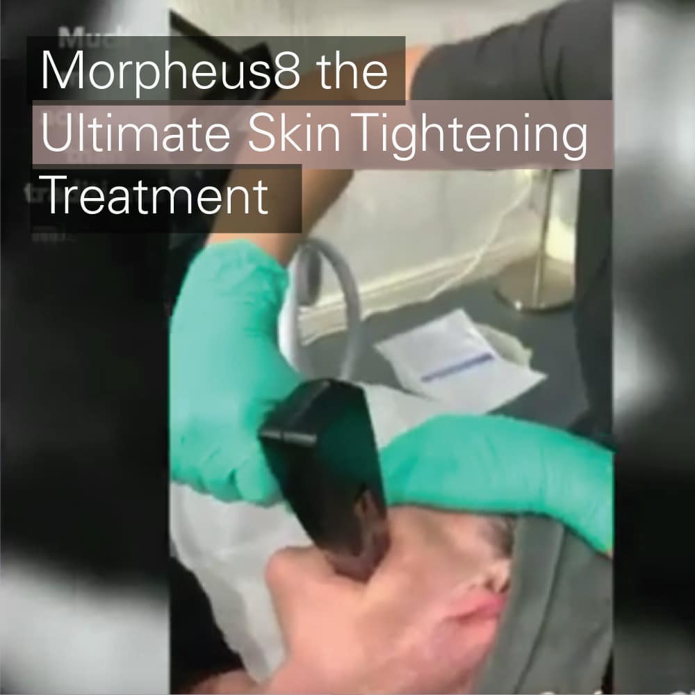 Morpheus8