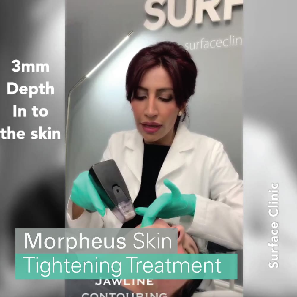 Morpheus8