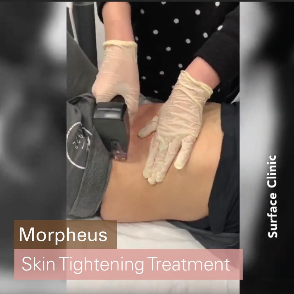 Morpheus8