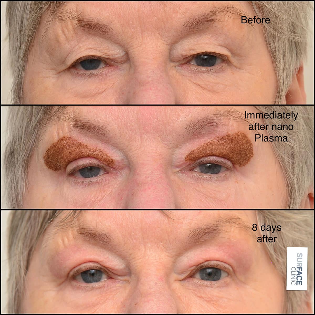 Eyes Result