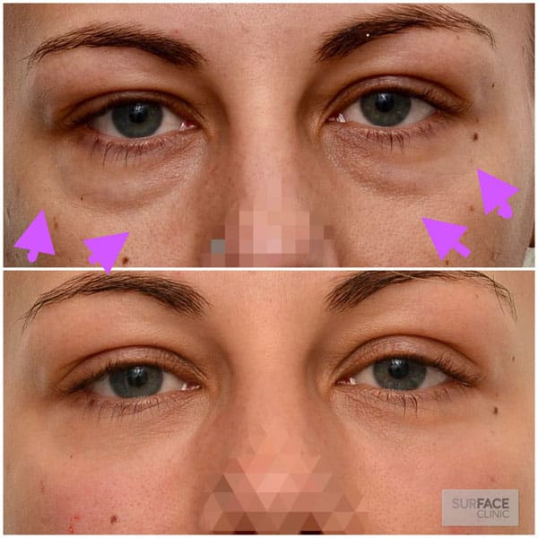 Anti-Ageing Result