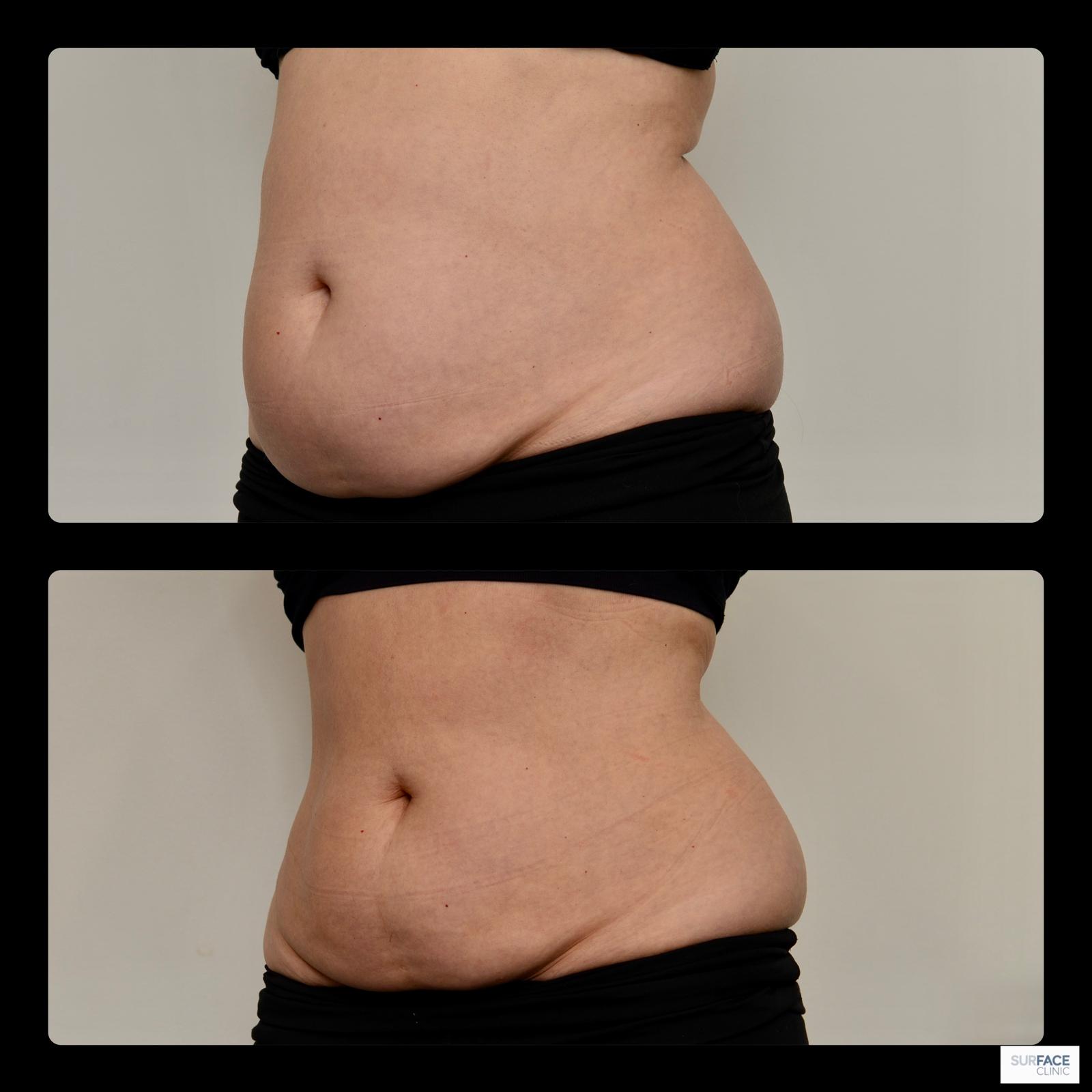 Body, Longevity & Biohacking Result