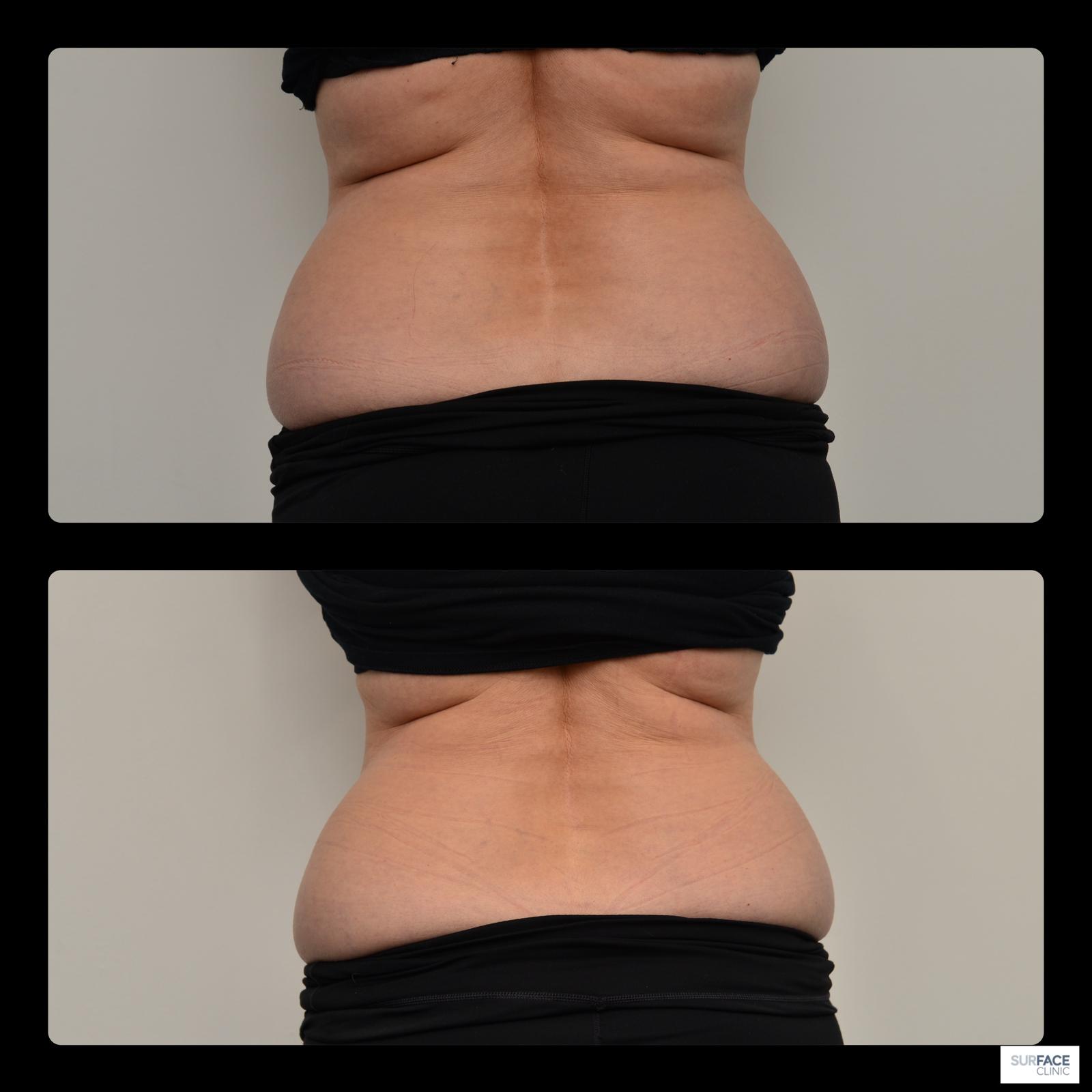 Body, Longevity & Biohacking Result