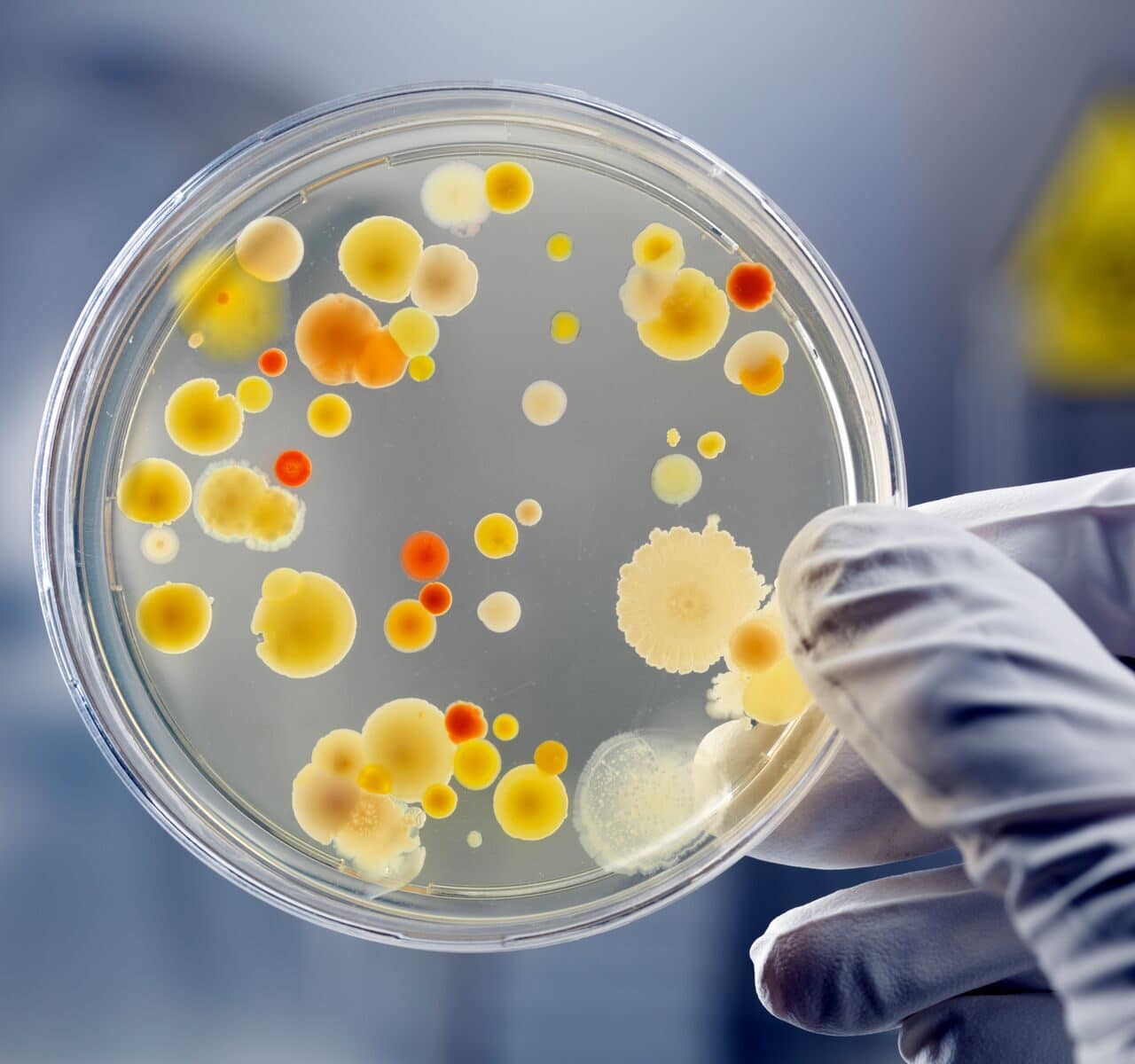 Food Sensitivities Test
