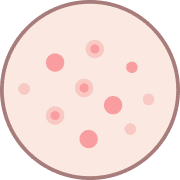 Acne Treatment York