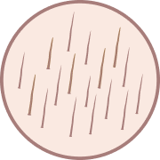 Laser Hair Removal Leeds