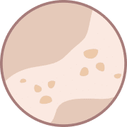 Pigmentation Treatment Bradford
