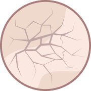 Skin Rejuvenation Leeds