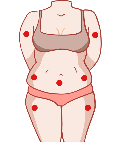 Fat Loss Leeds