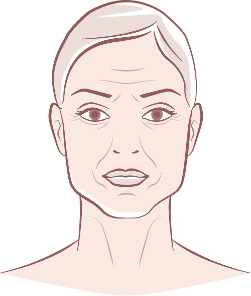 Anti-ageing Treatment Bradford