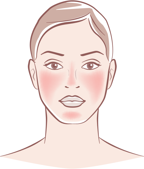 Menopause Treatment Leeds