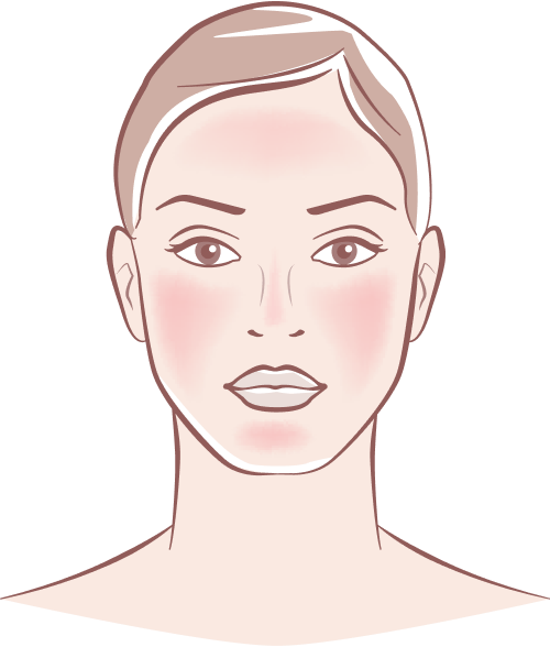 Rosacea Treatment Bradford