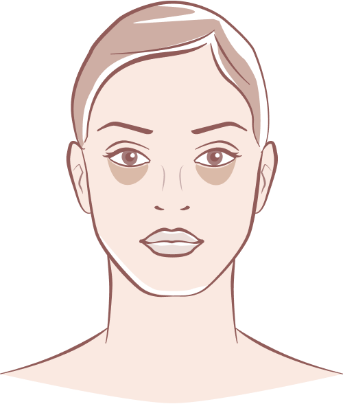 Pigmentation Treatment Bradford